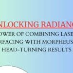 Unlocking Radiance: The Power of Combining Laser Skin Resurfacing with Morpheus8 for Head-Turning Results